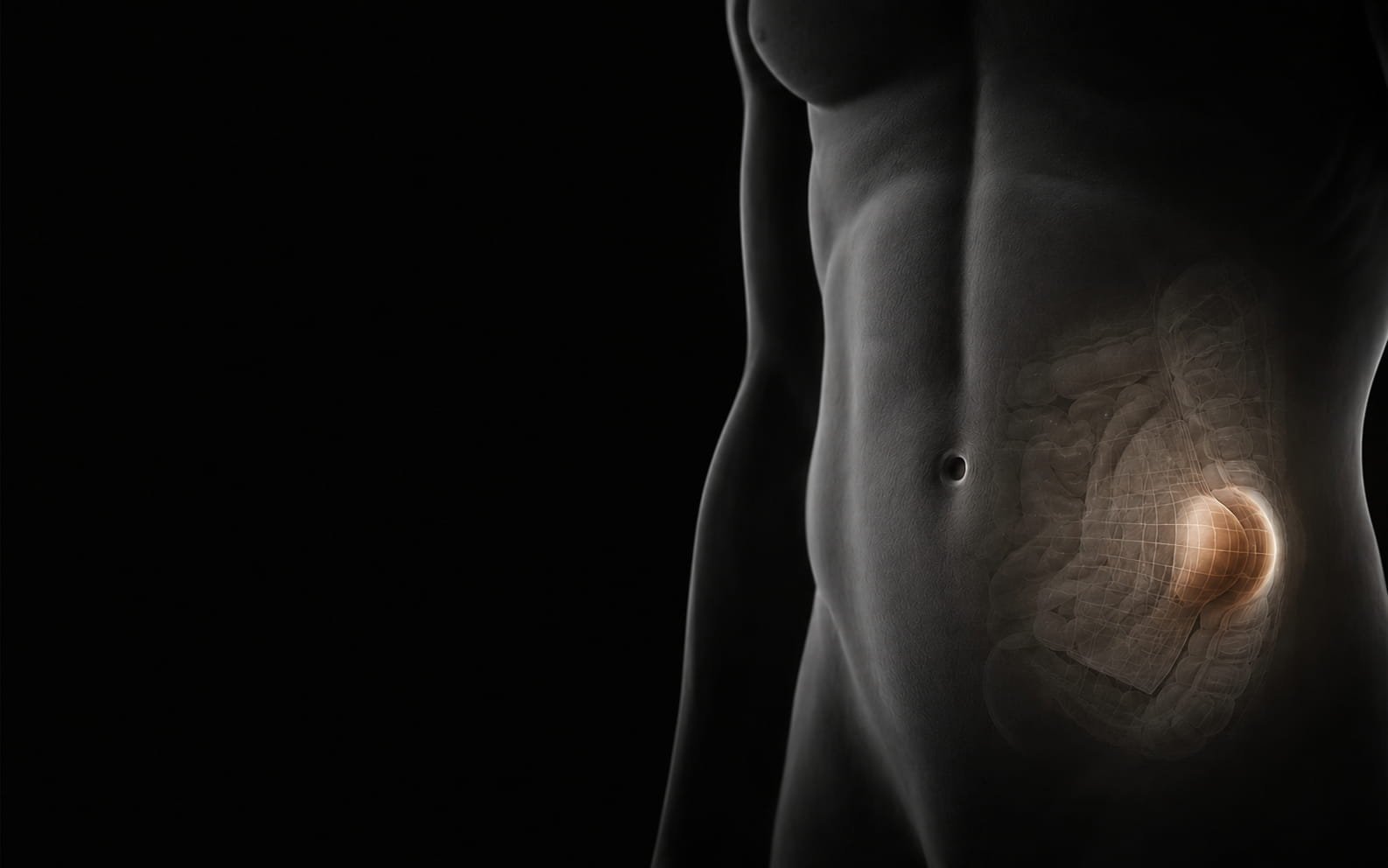 Representação anatômica de correção de hérnia abdominal
